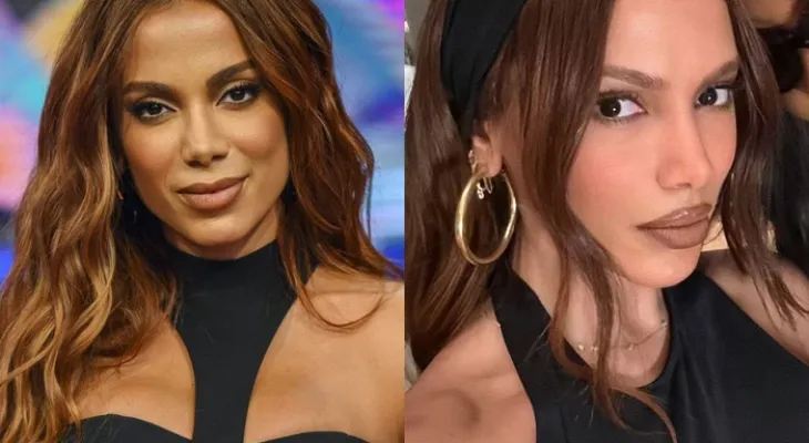 Anitta revela já ter feito mais de 50 procedimentos estéticos ao longo da vida
