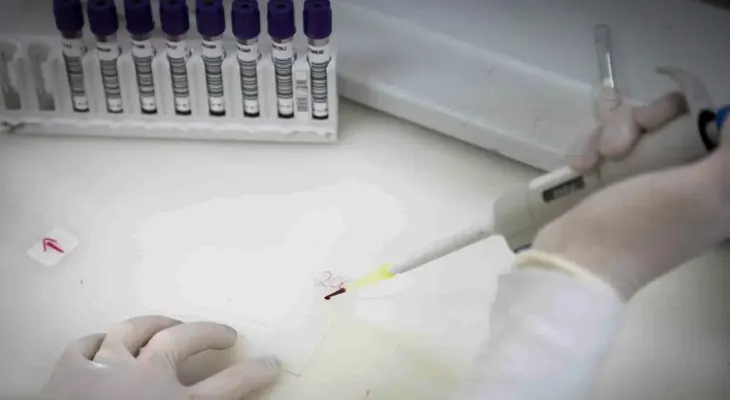 Exames descartam ebola em imigrante internado em São Paulo