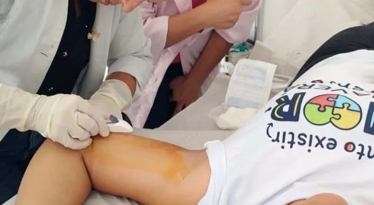 Procura por implante contraceptivo gratuito no SUS cresce 380% no Paraná