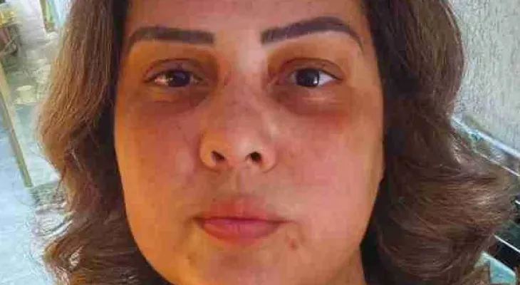 Identificada como Fabiana Pedrão Nunes motorista que morreu em acidente na BR-369